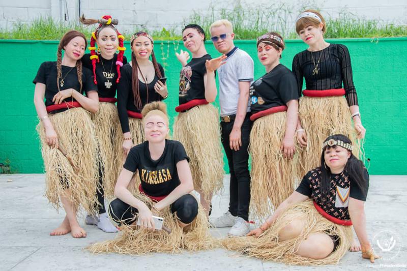 Lees meer over het artikel Haut-Katanga: project om kinderen met albinisme meer kansen te geven op school (CongoForum)